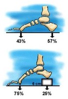 Soluciones al dolor de tacones
