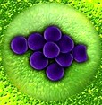 PharmaMar firma un acuerdo de licencia y comercialización para APLIDIN® (plitidepsina) con Specialised Therapeutics Australia Pty