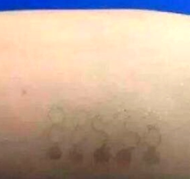 Científicos desarrollan una piel electrónica parecida a un tatuaje