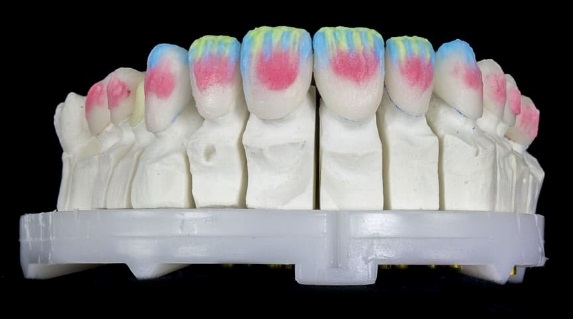 Las mejores prótesis dentales para tu clínica