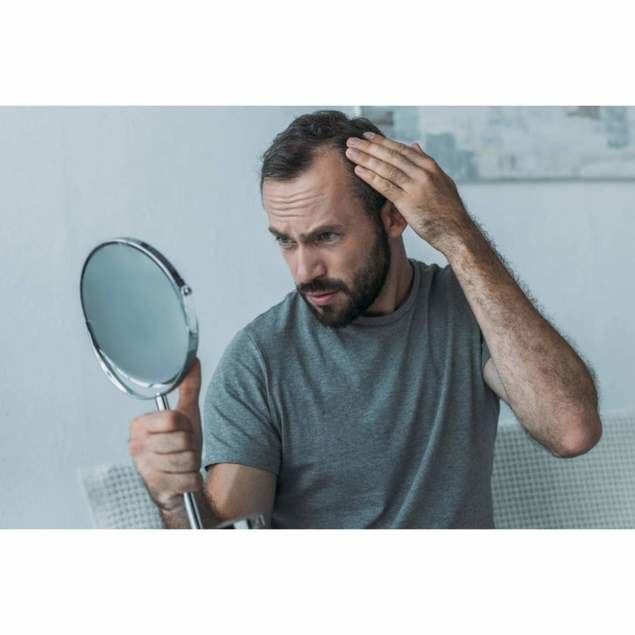 Prevenir la caída del cabello en Barcelona gracias a Dr. Carlos Zito