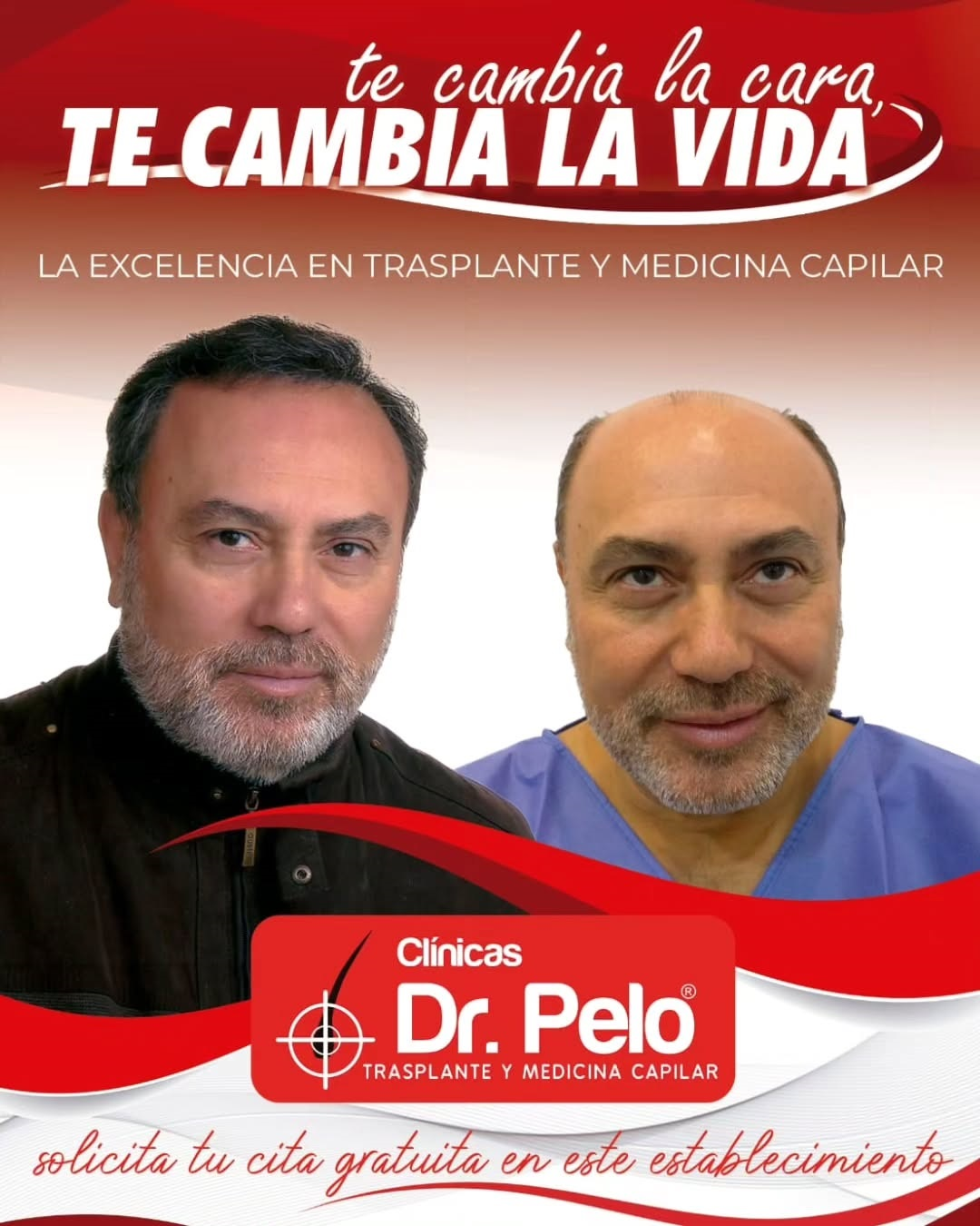 El reto de la calvicie avanzada: así es el injerto capilar más exigente que se realiza en Sevilla