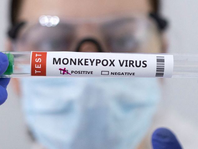 Ascienden a más de 15.000 los casos de viruela del mono detectados en Estados Unidos