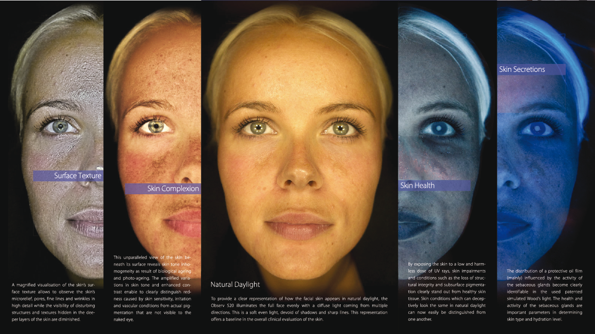 Tecnología de fluorescencia para ver la evolución de la piel en los tratamientos estéticos