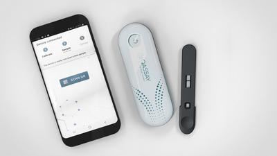 Qassay, test rápidos para la detección de enfermedades con IA