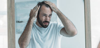 ¿Tener entradas significa necesariamente sufrir alopecia?