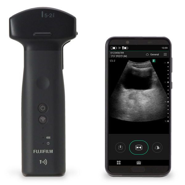 Fujifilm se especializa en el desarrollo de la ultramovilidad con equipos de radiodiagnóstico